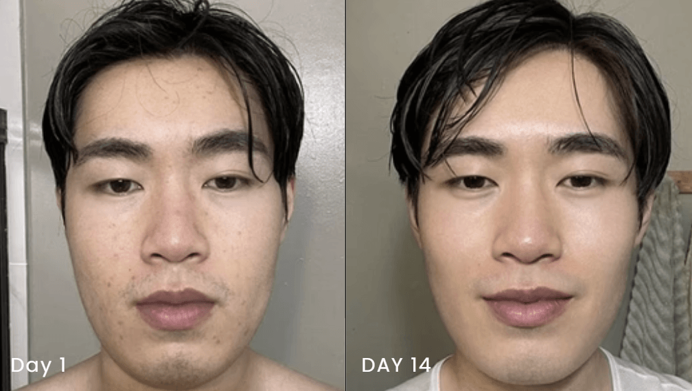 ANUA 5 - step Korean Skincare Set - Koreancosmetic