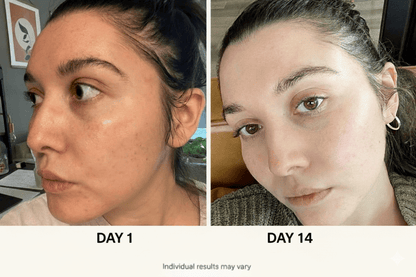 ANUA 5-step Korean Skincare Set