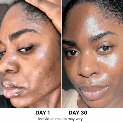 ANUA 5-step Korean Skincare Set