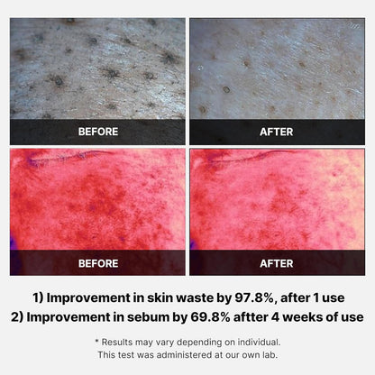 Medicube Red Succinic Acid Peeling Pad - Koreancosmetic