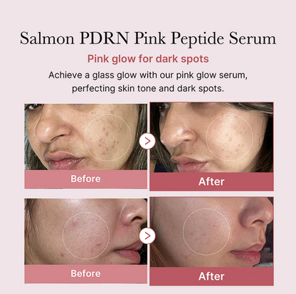 Medicube PDRN Pink Peptide Serum